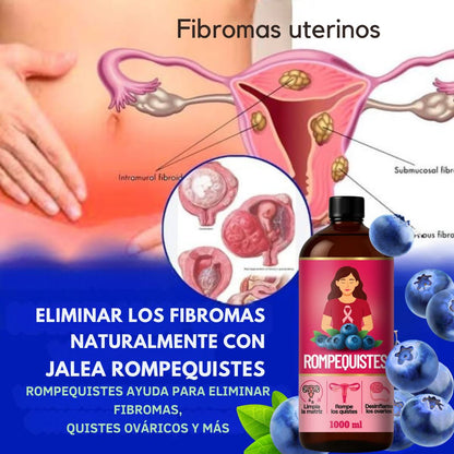 ✨ Jalea Rompe Quistes: Tratamiento Natural para tu Salud Femenina ✨